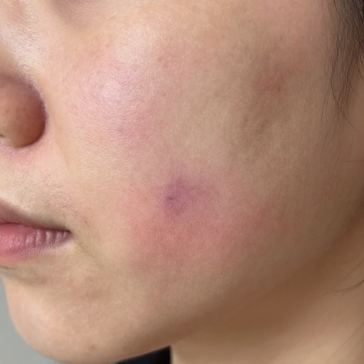 JAW LINE - Light Touch